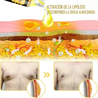 Bee Venom Gynecomastia Heating Oil 15 ml (Pack of 2) 5wjxrz-wh