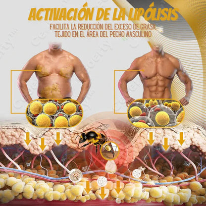 Bee Venom Gynecomastia Heating Oil 15 ml (Pack of 2) 5wjxrz-wh